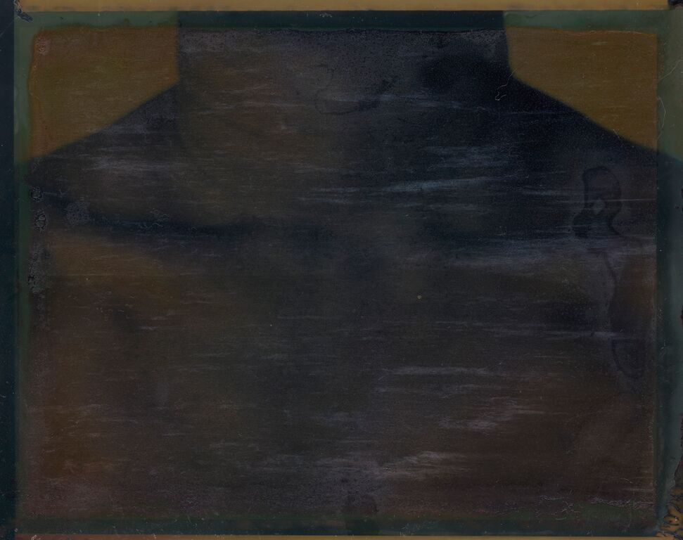 Myra Greene; collar bone; 2002-2004